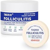 TAGRID Folliculitis Treatment Cream (5.5 Ounce)