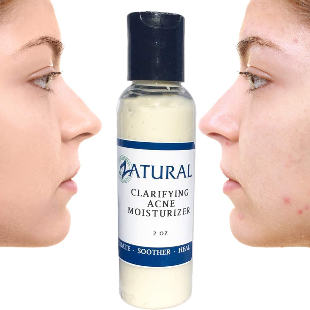 Naked Neem Clarifying Acne Moisturizer (2 Ounce)
