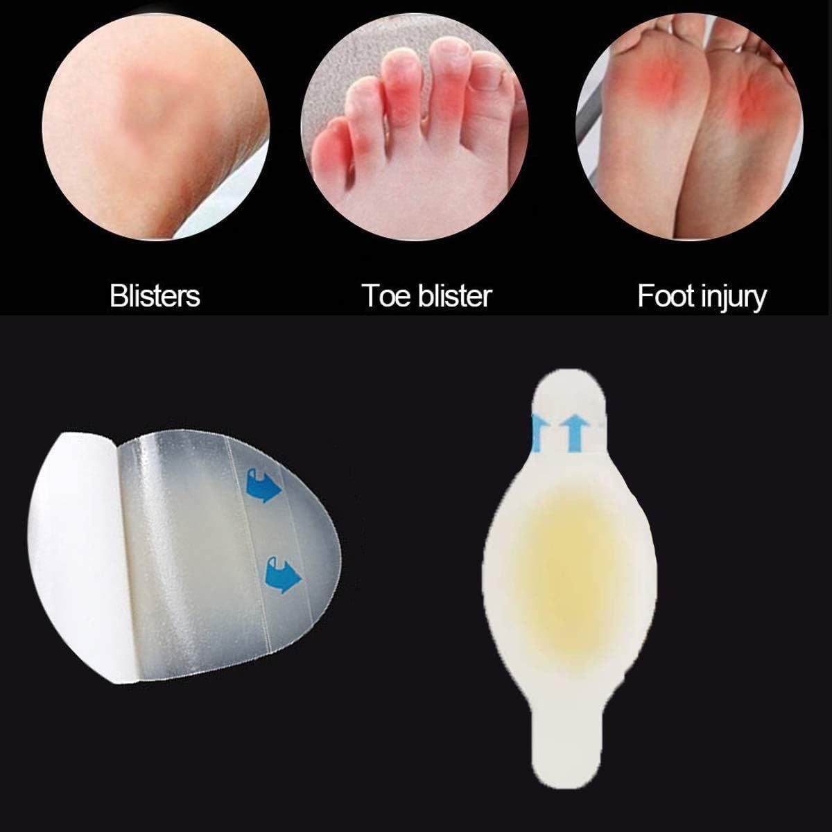 Mcvcoyh 18 Pack Blister Plaster Mix Pack - Image 3