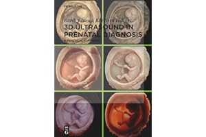 3D Ultrasound in Prenatal Diagnosis: A Practical Approach