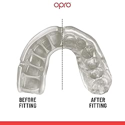 OPRO Instant Custom-Fit Sports Mouth