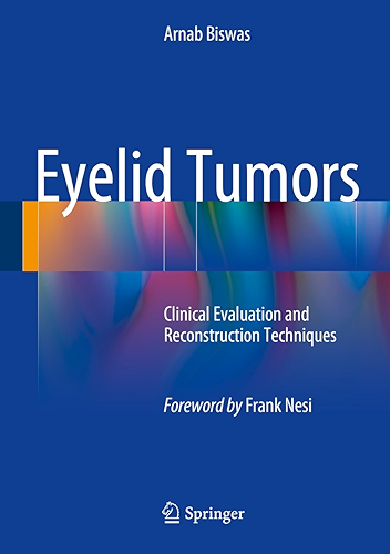 Download Eyelid Tumors: Clinical Evaluation and Reconstruction Techniques (English Edition) PDF