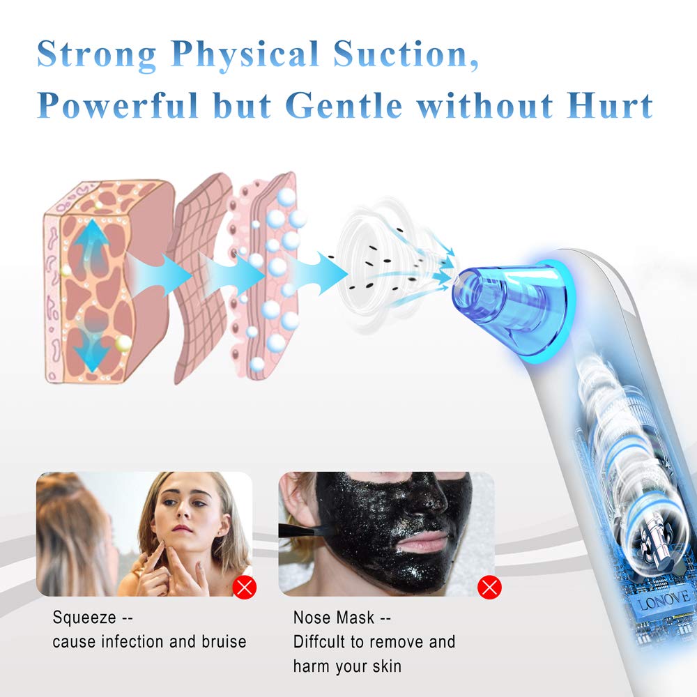 Blackhead Remover Pore Vacuum Extractor - LONOVE Upgraded Blue Light Blackhead Vacuum Pore Cleaner Electric Comedone Acne Extractor Kit Whitehead Black Head Removal Tool,LED Screen and 4 Porbes: Beauty
