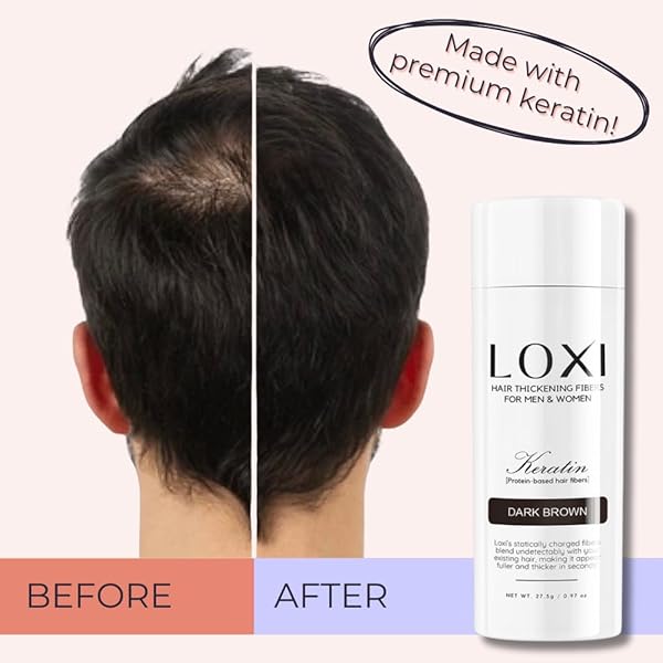 LOXI HAIR BUILDING FIBERS (27.5G) | FILL IN FINE, THINNING & BALDING HAIR FOR AN INSTANTLY THICKER & FULLER LOOK | PREMIUM KERATIN FORMULA | 5 SHADES FOR MEN & WOMEN (BLACK).