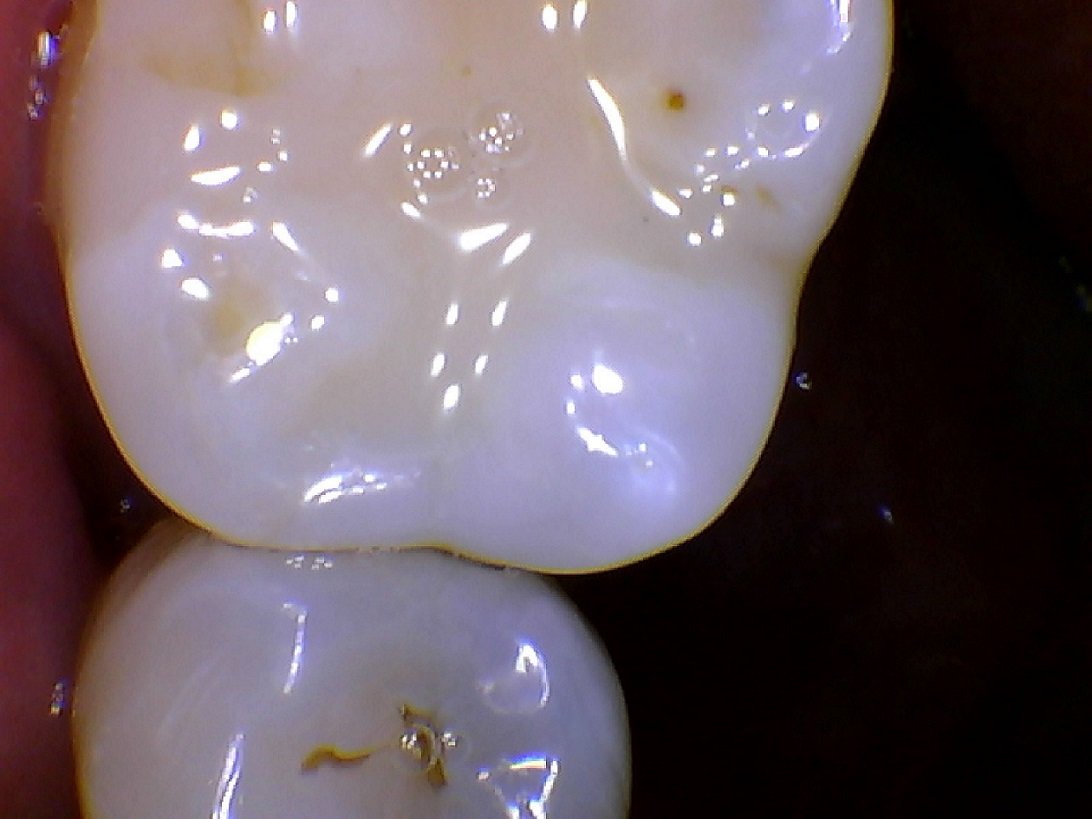 DARYOU DY50 Intraoral Camera Dental Camera ,Super Clear