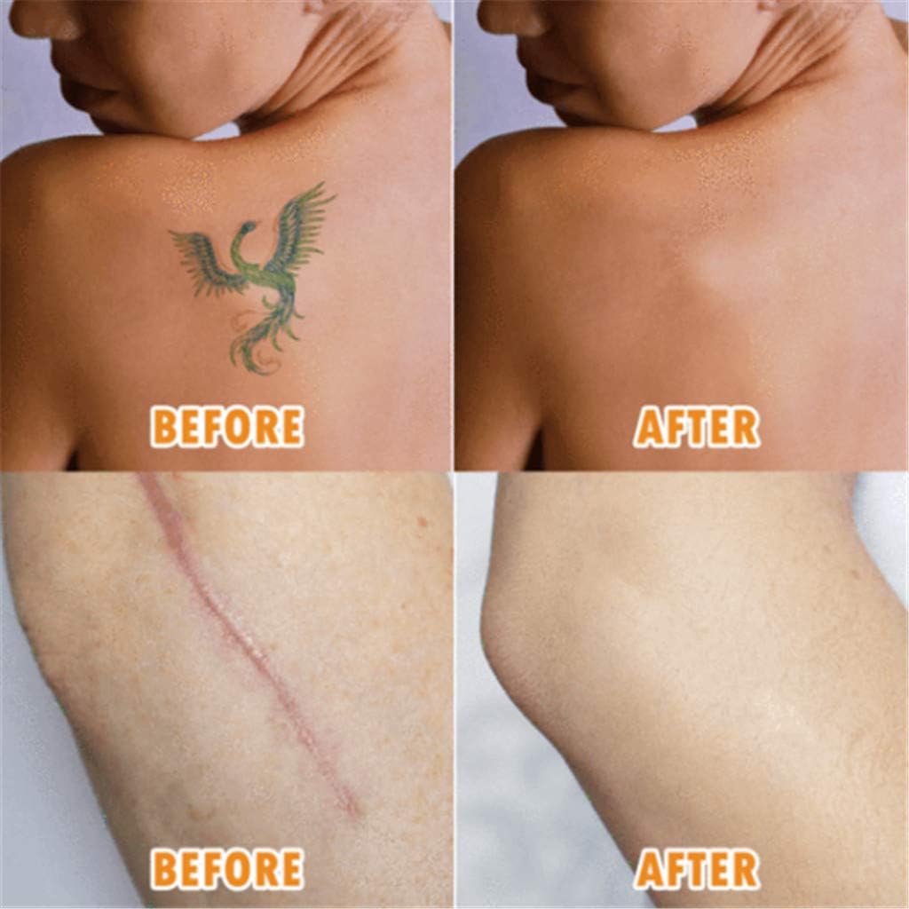  Breathable Tattoo Flaw Concealing Tape