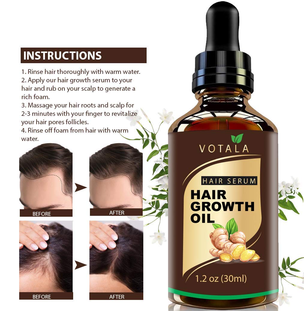 Hair Growth Serum, Votala Hair Growth Treatment, Hair Serum, Anti Hair Loss, Thinning, Balding, Repairs Hair Follicles, Promotes Thicker, Stronger Hair, And Promotes Hair Regrowth : Beauty