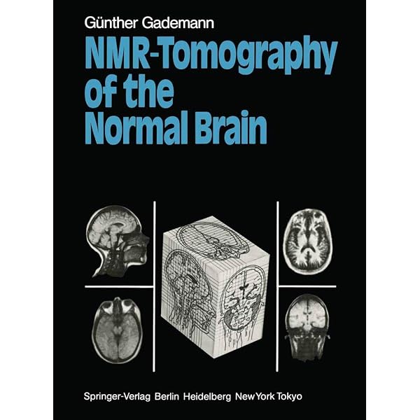 Diffusion Tensor Imaging: Introduction and Atlas: 9783662505632