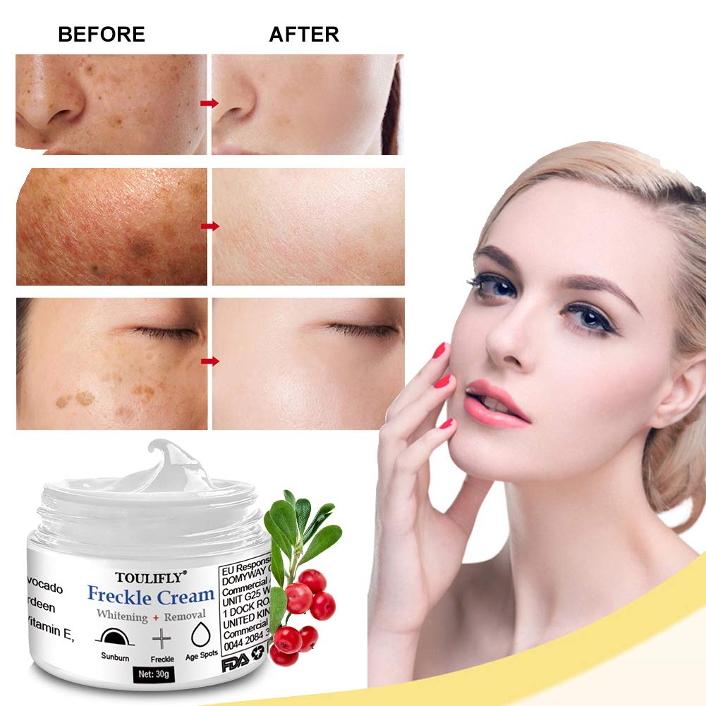 pinpoxe freckle cream