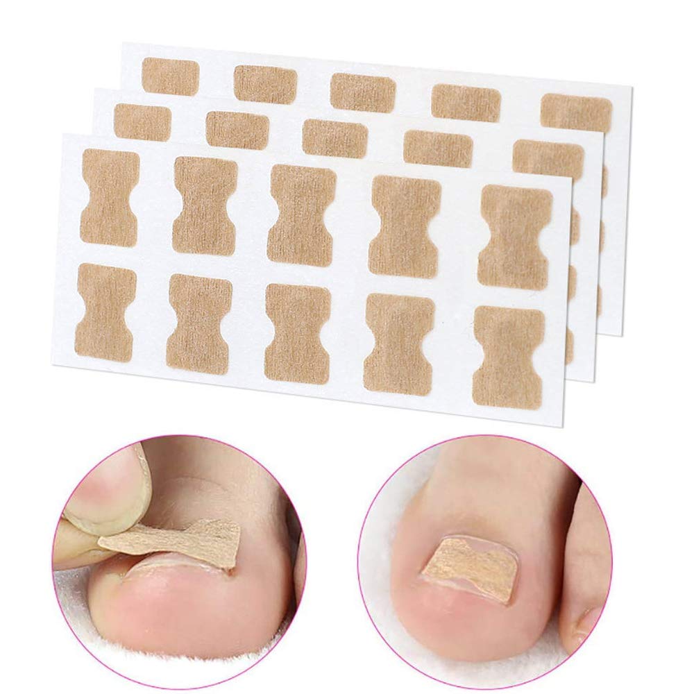 3 Set Glue Free Toenail Patch - Ingrown Toenail Correction Sticker Professional Pedicure for Men Women Toenail Care Tool: Beauty