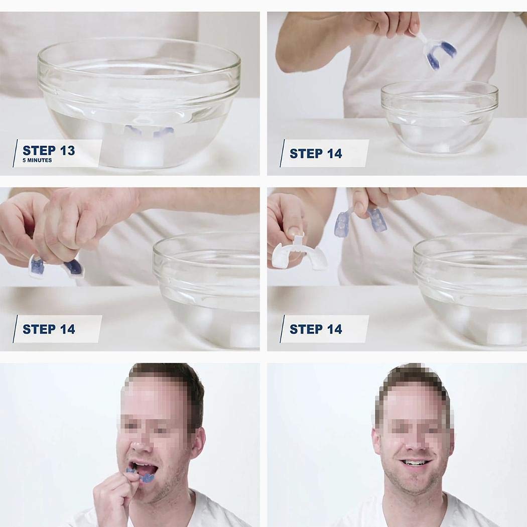 Zuionk Dental Mundschutz verhindern Nacht Zähneknirschen Schlafmittel gesunde Pflege Schlaflosigkeit