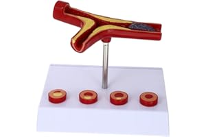 BESTYASH Cardiovascular Model with Thrombus Simulation, Elderly Human Heart Anatomy Teaching Model for Medical Education
