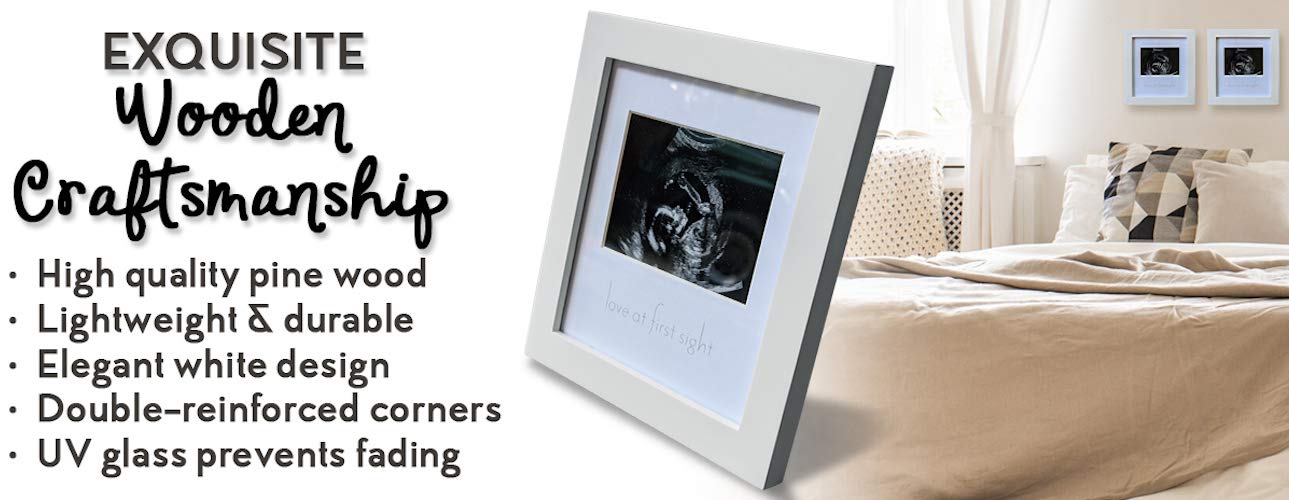 Green Pollywog Sonogram Photo Display | White Ultrasound Frame | Pregnancy Gift for First-Time Moms, Parents & Grandparents | Nursery Decor