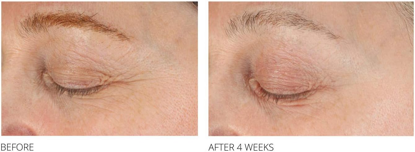 MEG 21 Bright and Firm Eye Treatment 15 g - Image 4