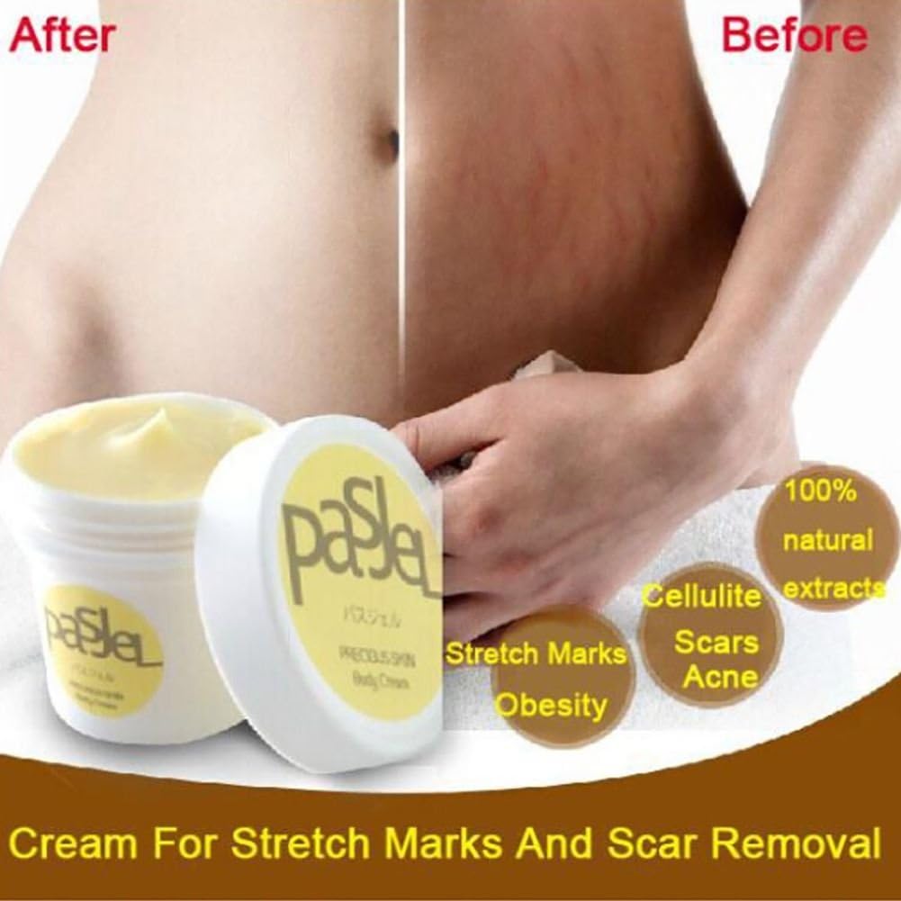 50g Pregnancy Repairing Cream,Allouli Stretch Marks Remover Cream Scar
