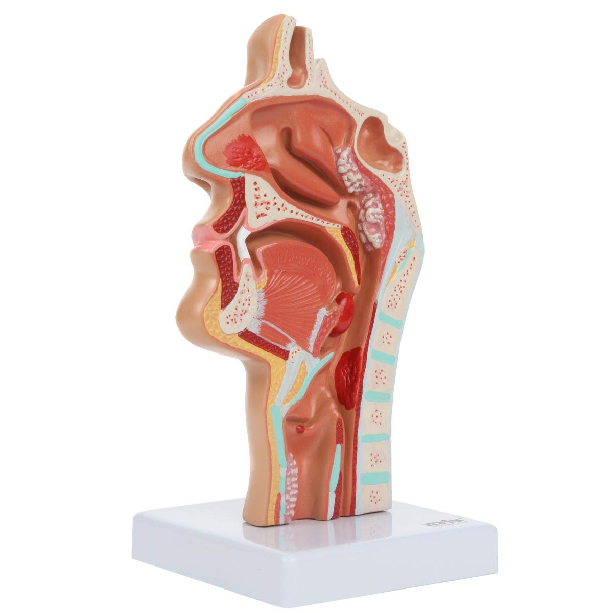Axis Scientific Human Larynx and Pharynx Disorders Model | Shows Normal Larynx and Pharynx Anatomy and Details Common Abnormalities | Comes on White Base