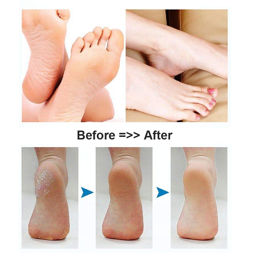 BOMPOW Foot Scrubber Electric Callus Remover Rechargeable Foot File Hard Skin Remover Pedicure Tools Electronic Callus kit for Cracked Heels and Dead Skin with 2 Roller Heads, Blue : Beauty
