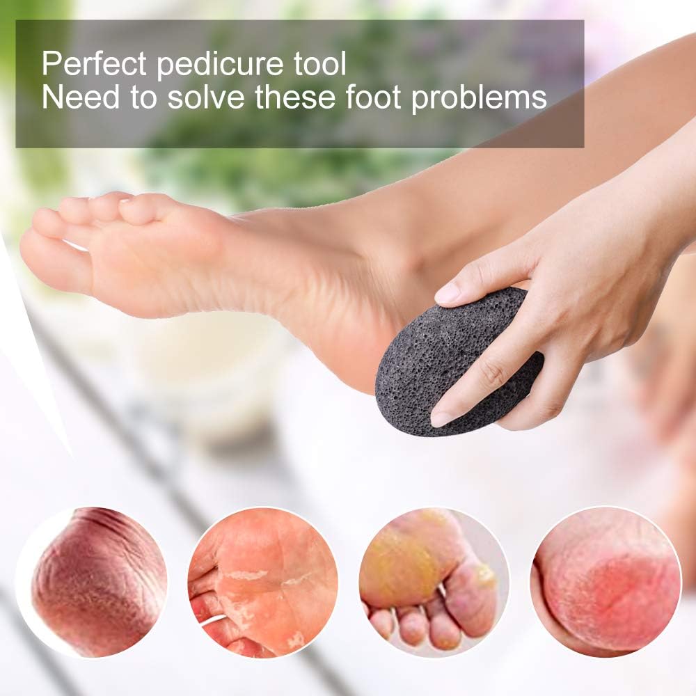 PETSUPS Natural Pumice Stones for Feet Premium Exfoliator & Foot File,Foot File Callus Remover Foot Cracked Heels,Dead Skin,Hard Skin - Image 3