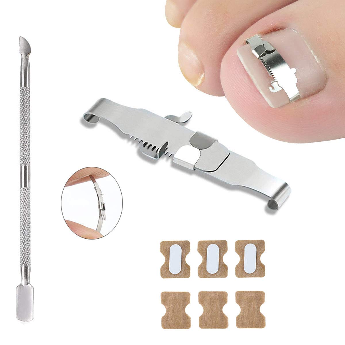 Ingrown Toenail Tools Kit, Include 2pcs Ingrown Toenail Correction Buckle and Toenail Lifter, 2 Sheets Ingrown Toenail Correction Patches for Ingrown Toe Nails Foot Care Tools: Beauty