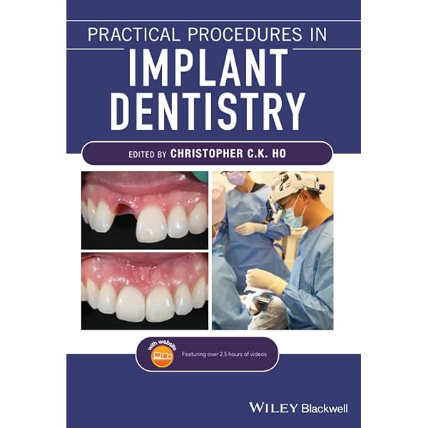Peri-implant Infection インプラント周囲感染症 洋書 Peri-implantitis | Stefan Renvert / Jean-Louis Giovannoli