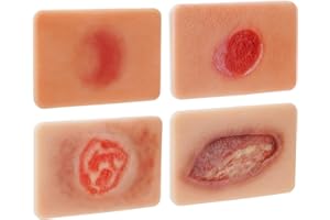 PER4MANCE Pressure Ulcer Wound Model Stages I–IV: Silicone Decubitus Care Training Kit for Nursing Practice & Medical Education