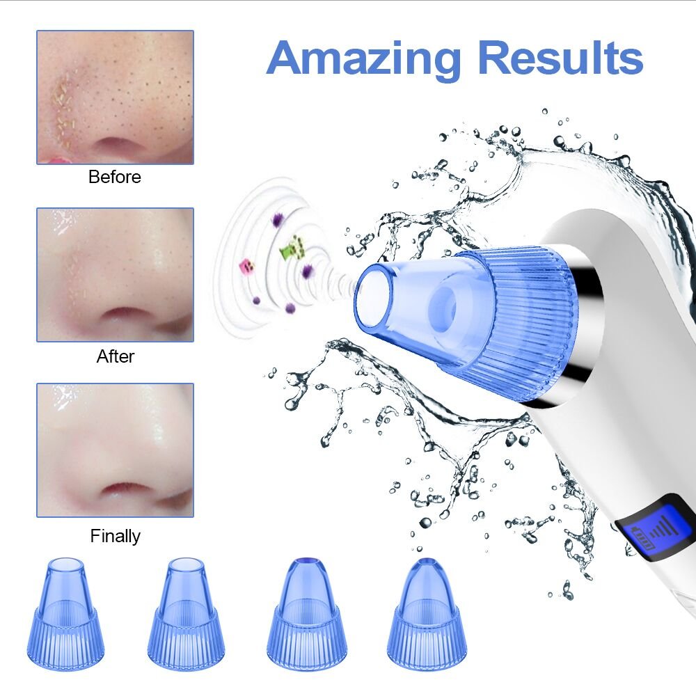 coofo blackhead remover vacuum pore acne cleanser
