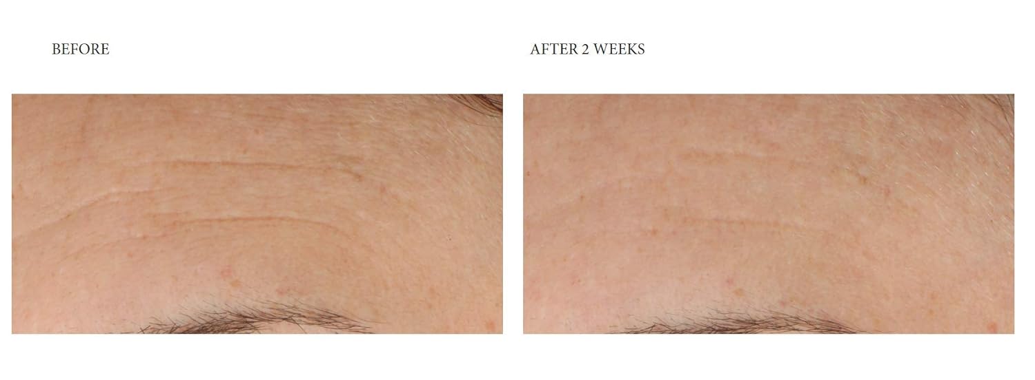 dr dennis gross stress rescue