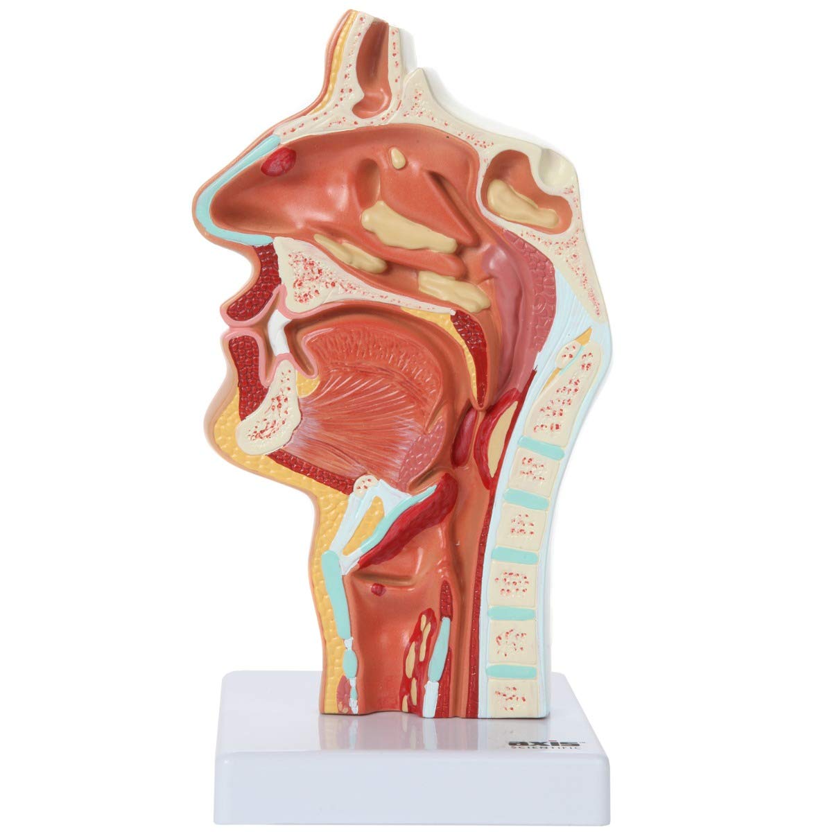 Axis Scientific Human Larynx and Pharynx Disorders Model | Shows Normal Larynx and Pharynx Anatomy and Details Common Abnormalities | Comes on White Base
