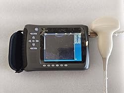 2023 Convex Newest Ultrasound Machine for Pregnancy