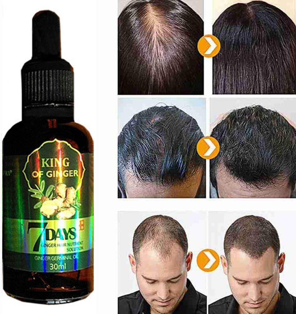 Hair Growth Serum, Hair Care Products, Ginger Hair Serum, Fast Hair Growth & Thickening Oil, Stop Hair Loss, Grow Hair Fast - Image 3