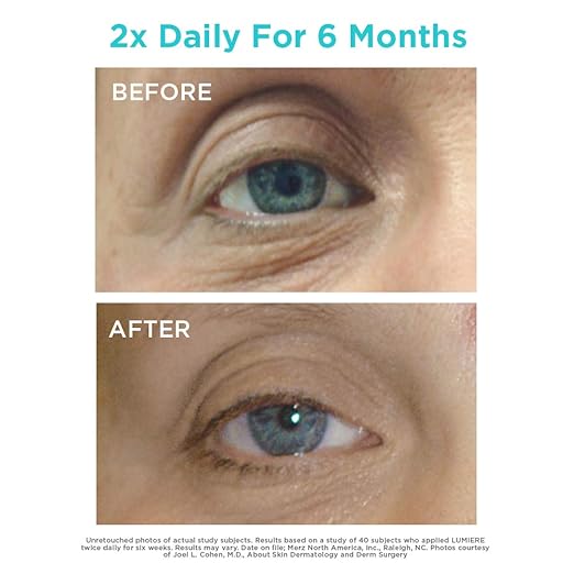 neo lumiere eye cream