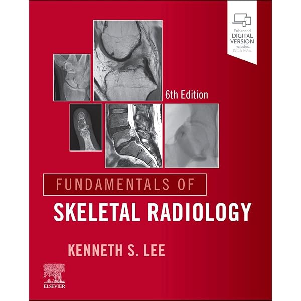 Orthopaedic Imaging: A Practical Approach: 9781975216818: Medicine