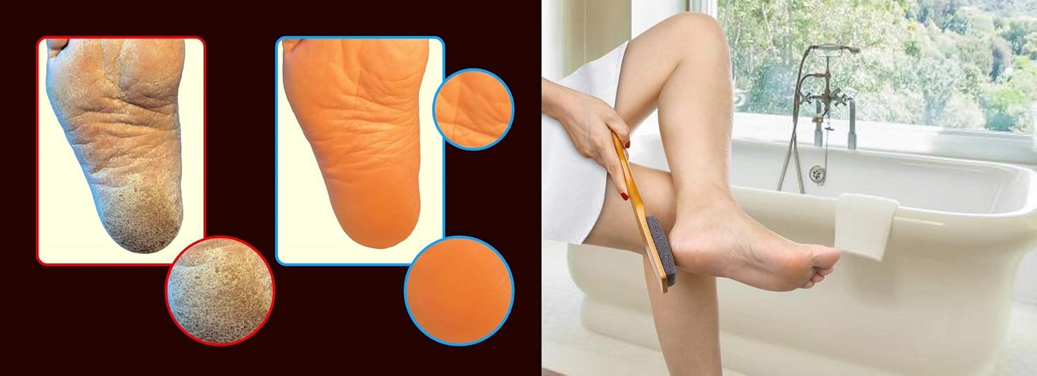 Professional Pedicure Foot File, Foot File Rasp, Callus Remover, Foot Scrubber - Perfect Foot Care for Cracked Heels - Corn Remover/File - Pedicure Tools, Heel Scraper File: Health & Personal Care