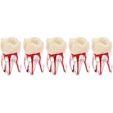 5Pcs Dental Root Canal Pulp Cavity Teeth Model Endodontic Practice RCT Typodont M8007 11# 14# 16# 21# 33# 34# 35# 36# 44# 45# Practicing Study Teach (5Pcs-M8007-16#)
