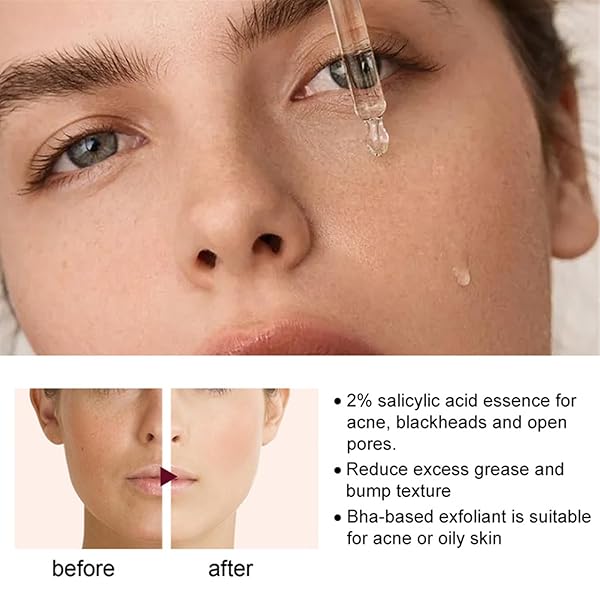 3PC FACE SERUM, ROZINO STOCK SOLUTION FACIAL SERUM, ROZINO 30 DAYS ADVANCED COLLAGEN BOOST ANTI-AGING FACE SERUM, ROZINO ANTI AGING SERUM, COLLAGEN SERUM FOR REPAIR AND GLOW SKIN
