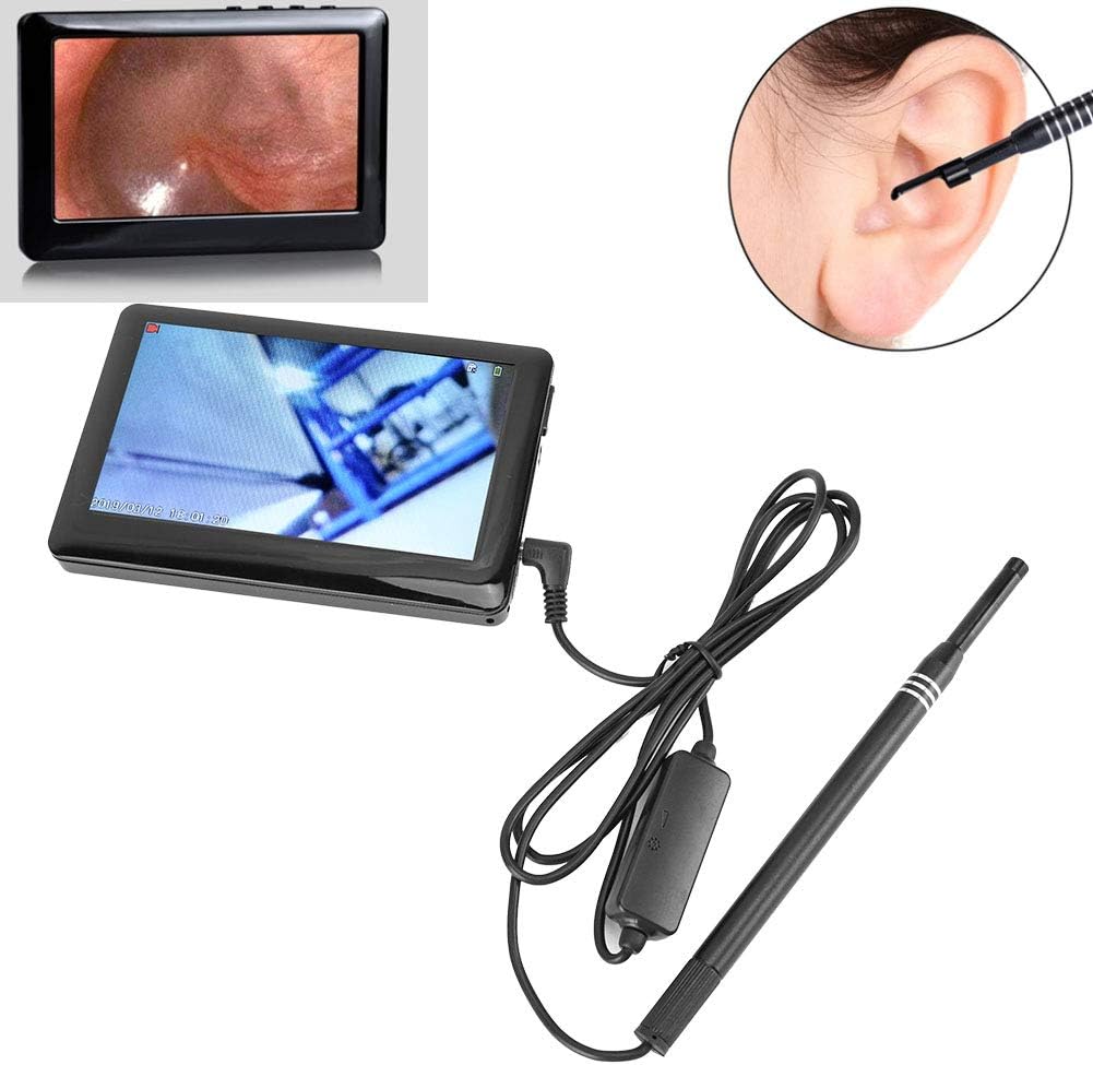USB Otoscope-Ear Scope Camera,4.3inch HD Screen Visual Ear Spoon Examination Endoscope Oral Nose Cavity Endoscope Visual Ear Camera HD Ear Endoscope