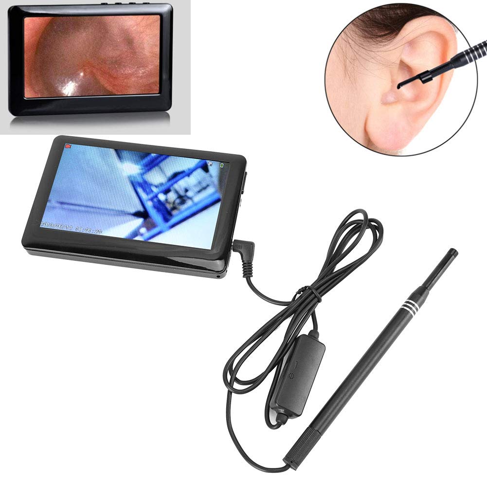 USB Otoscope-Ear Scope Camera,4.3inch HD Screen Visual Ear Spoon Examination Endoscope Oral Nose Cavity Endoscope Visual Ear Camera HD Ear Endoscope