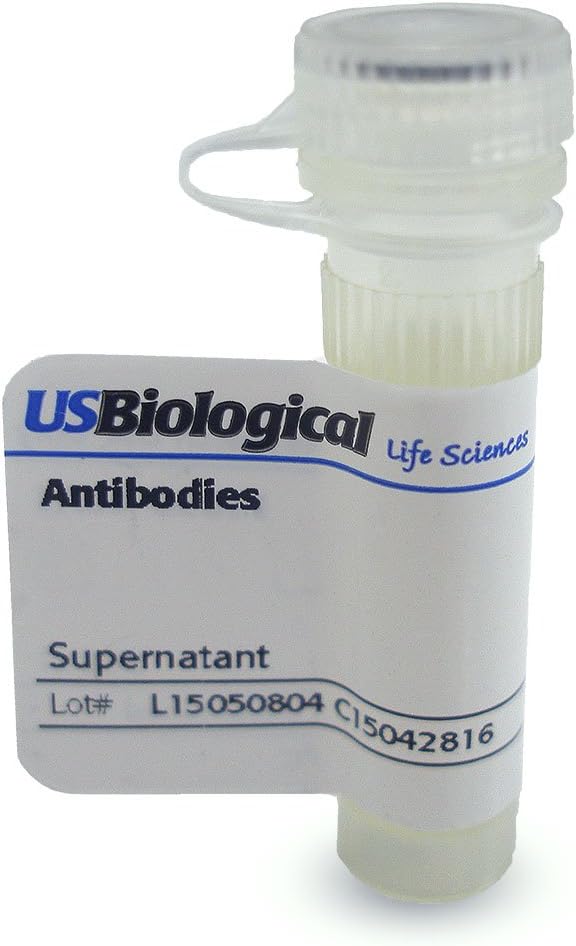 Nortriptyline, N4005-01-100ul