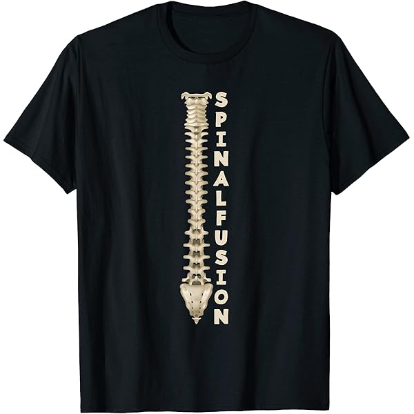 Amazon.com: Spine Back Surgery T-Shirt T-Shirt : Clothing Amazon.com: Spine Back Surgery T-Shirt T-Shirt : Clothing