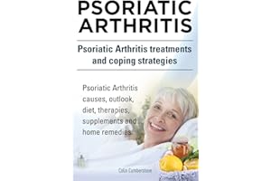 Psoriatic Arthritis. Psoriatic Arthritis treatments and coping strategies. Psoriatic Arthritis causes, outlook, diet, therapi