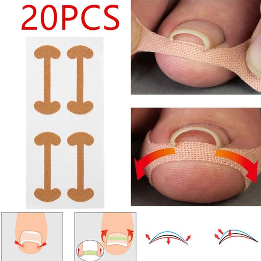 20 Pcs Ingrown Toenail Corrector Stickers, Toe Nail Treatment Elastic Patch Sticker Corrector Pedicure Tools Fingernail Toe Nail Care Protects Toe Nail: Beauty