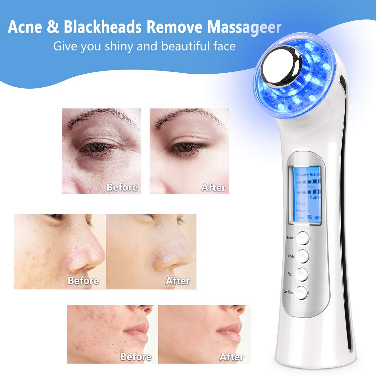 Face Beauty Machine White: Beauty