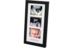 trlry Triple Ultrasound Picture Frames, Sonogram Picture Frame 3 Photos,Pregnancy Announcements,Pregnancy Gifts for First Time Moms,First Time Mom Gift,Black,Ultrasound Photo Album