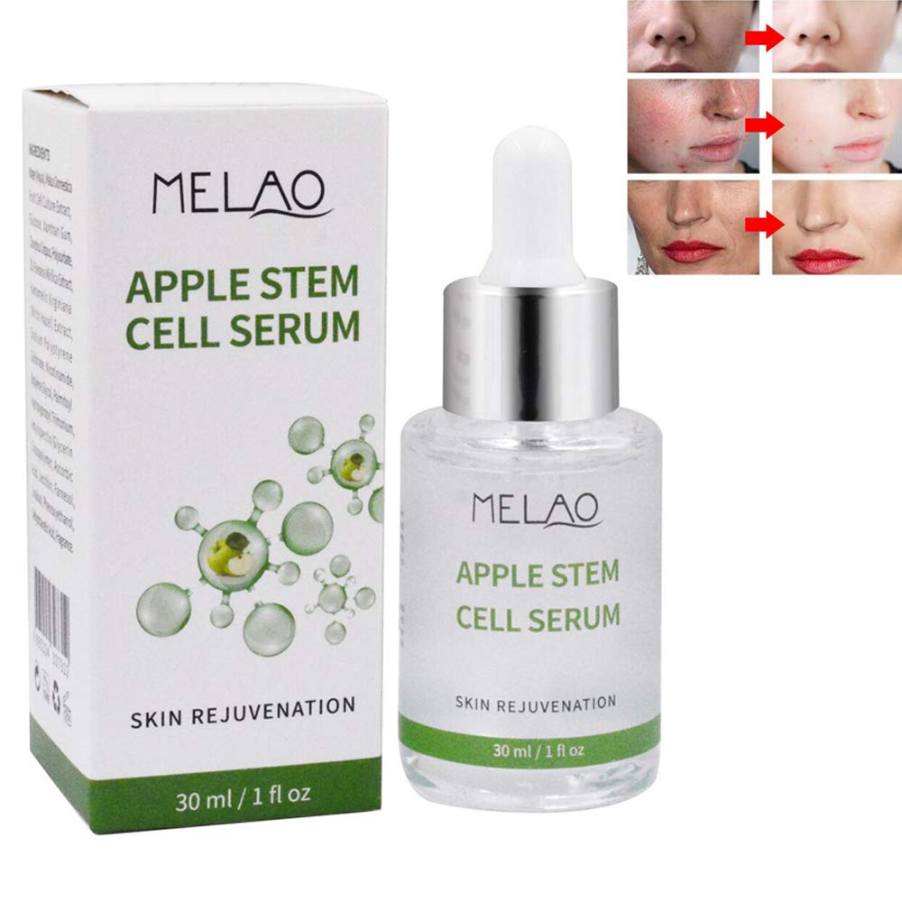 Face Skin Care Serum Apple Stem Cell Liquid for Anti-Wrinkle, Anti-Aging, Removing Acne, Cleaning Pores, Restore Skin Elasticity