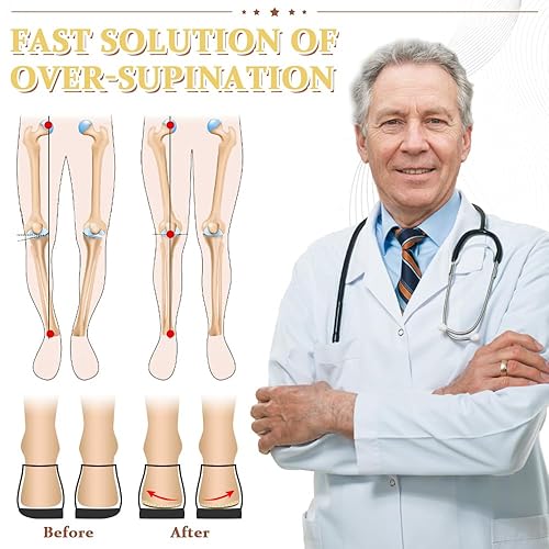 Knee Overpronation Correction Bow Legs Best Shoe Insert For Knee