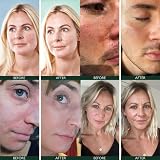 S Sorted Sorted Skin 5 in 1 Anti-Redness CC Cream SPF50 30ml view 4