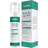 Adellina Back Acne Spray, Body Acne Treatment with Salicylic Acid, Tea Tree Oil & Niacinamide, 4 oz