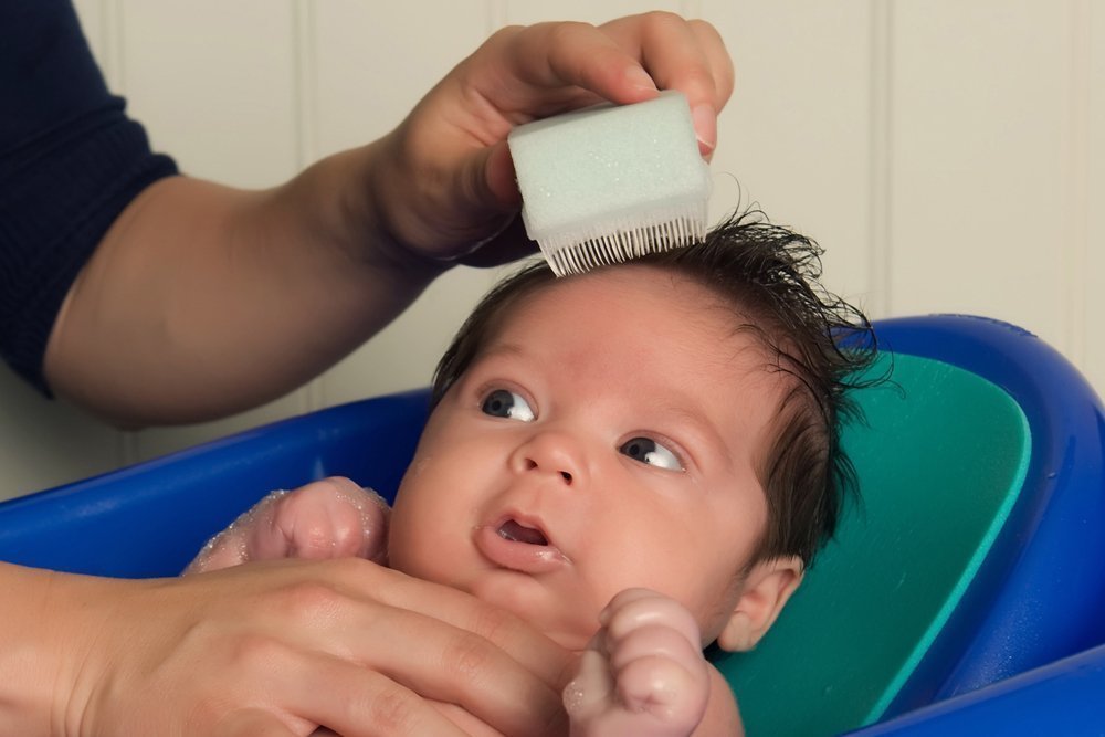 Scalp Scrubbie 3-pk, Sterile, Cradle Cap and Baby Bath Time Sponge Brush : Baby Skin Care Products : Baby