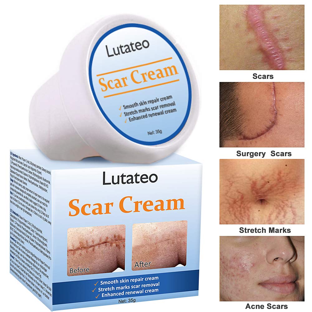 Scar Cream, Scar Treatment, Stretch Mark Cream, Scar Removal Cream