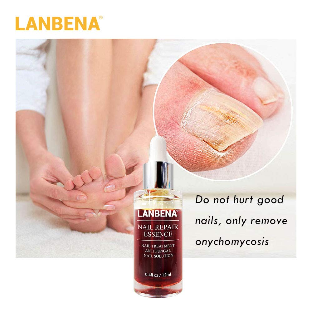 Nails Repair, LANBENA Nail Treatment Nail Care Serum Protect Nail from Damage Fingernail and Toenail Repair for Curing Athlete's Foot and Prevent Nail from Infection Discolored & Damaged Nails(12ml) : Beauty